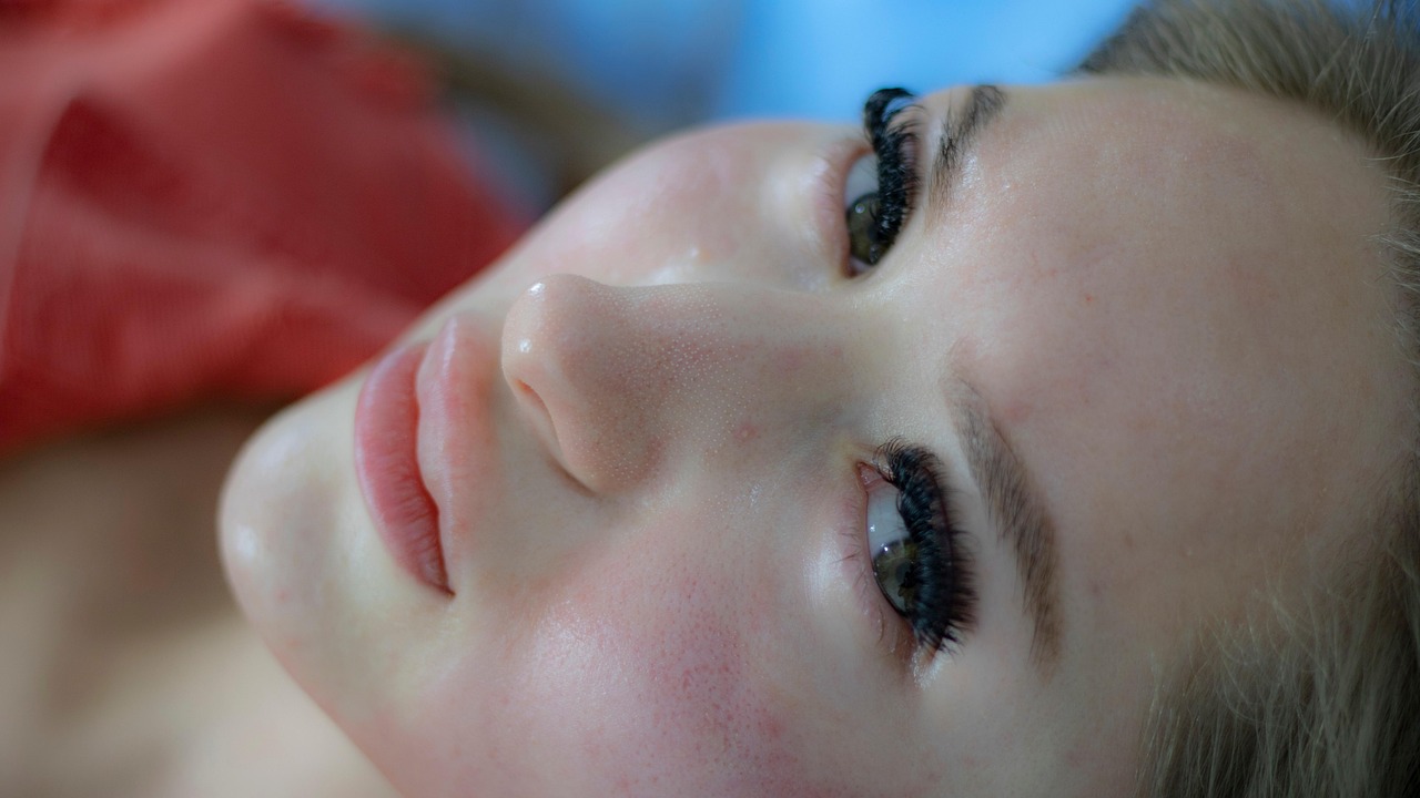 woman, skincare, facial treatment, dermatology, acne scars, skincare, skincare, facial treatment, dermatology, dermatology, dermatology, dermatology, dermatology, acne scars